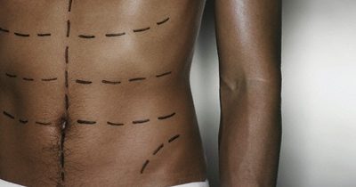 Anatomía de los músculos abdominales